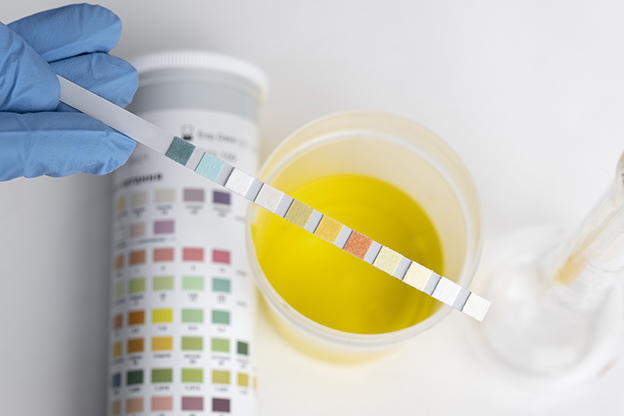 Drug Testing Services in Fort Pierce